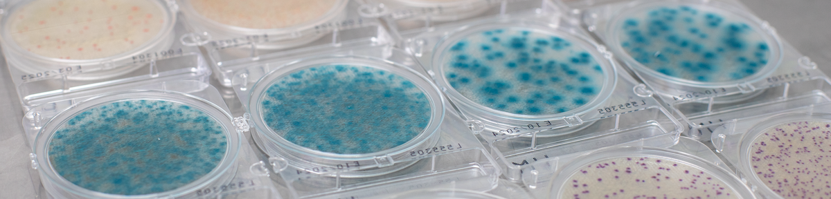 One second colony counts — with records built in